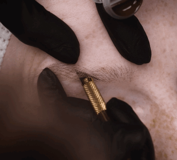 Manual Nanostroking® Needles